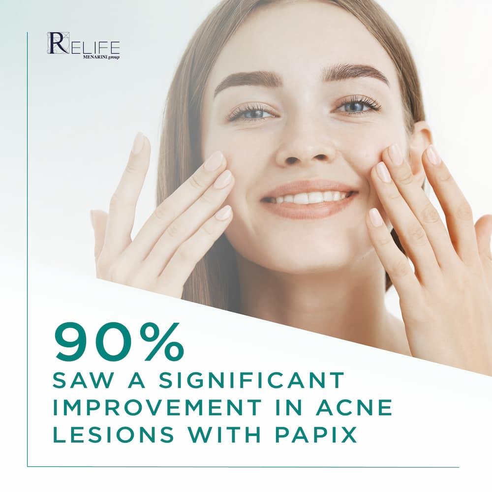 Relife PapiX Cleanser for Acne Prone Skin 200ml