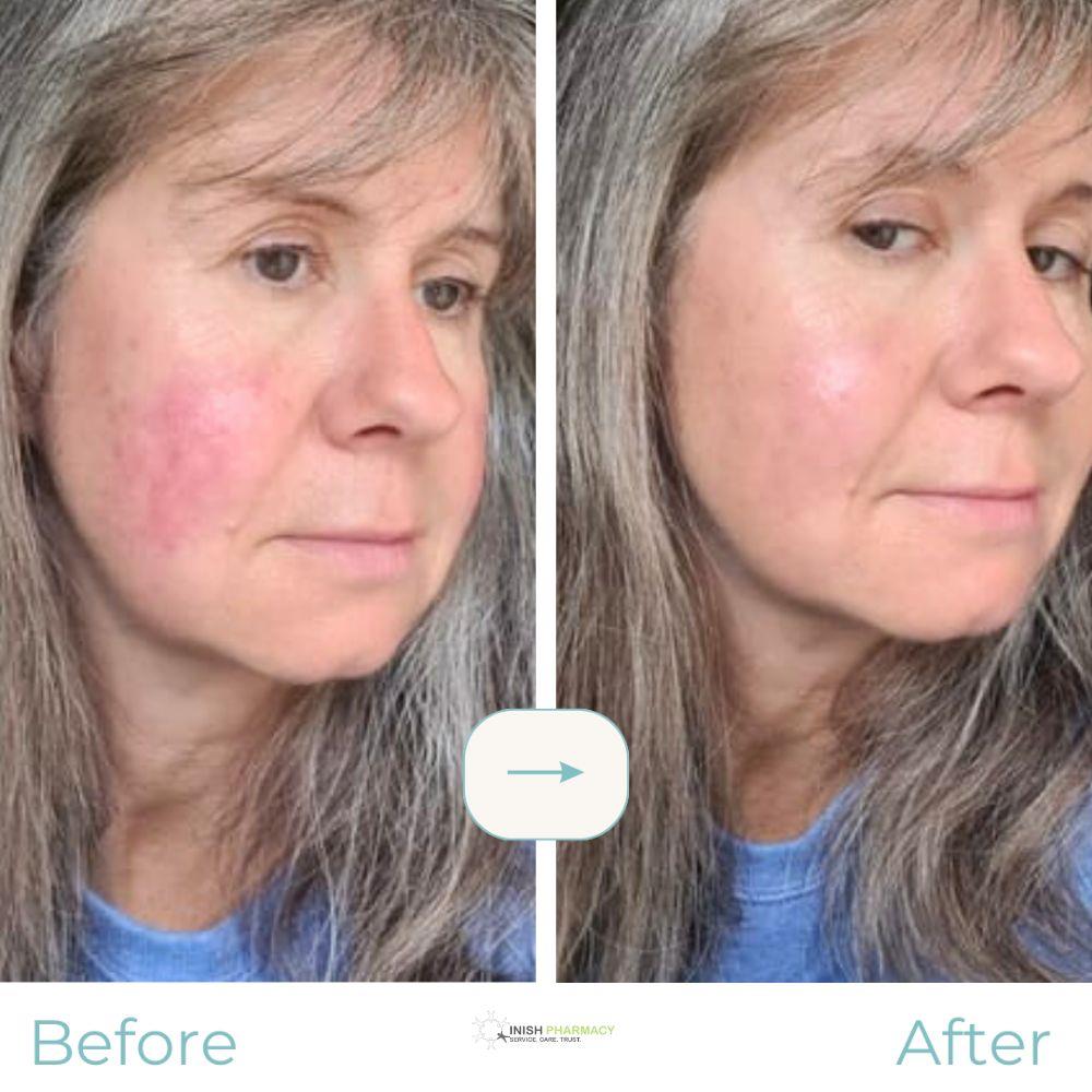 Rosalique 3-in-1 Anti-Redness Miracle Formula SPF50