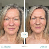 Rosalique 3-in-1 Anti-Redness Miracle Formula SPF50