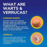 Scholl Freeze Away MAX Verruca & Wart Remover