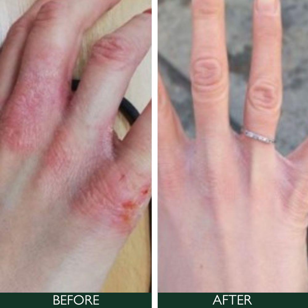 Sorted Skin 5 In 1 Anti-Redness Day Cream SPF50 30ml