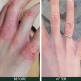 Sorted Skin 5 In 1 Anti-Redness Day Cream SPF50 30ml