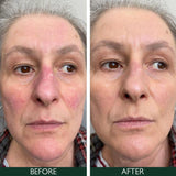 Sorted Skin 5 In 1 Anti-Redness Day Cream SPF50 30ml