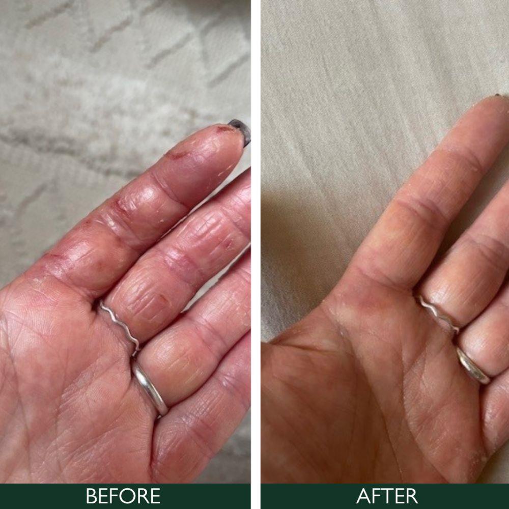 Sorted Skin 5 In 1 Anti-Redness Day Cream SPF50 30ml