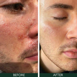 Sorted Skin 5 In 1 Anti-Redness Day Cream SPF50 30ml