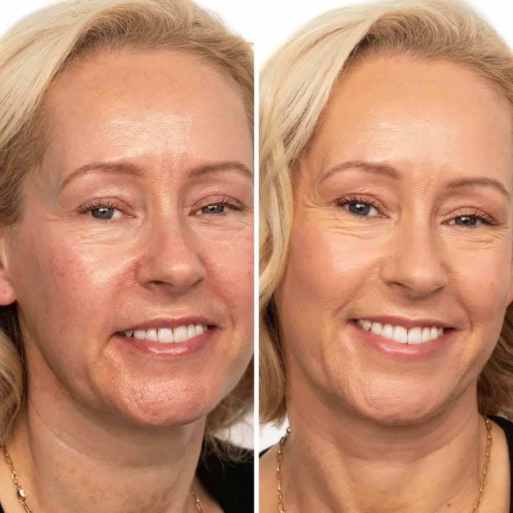 SOSU Dripping Gold CC Me In Foundation 3.5 Sand