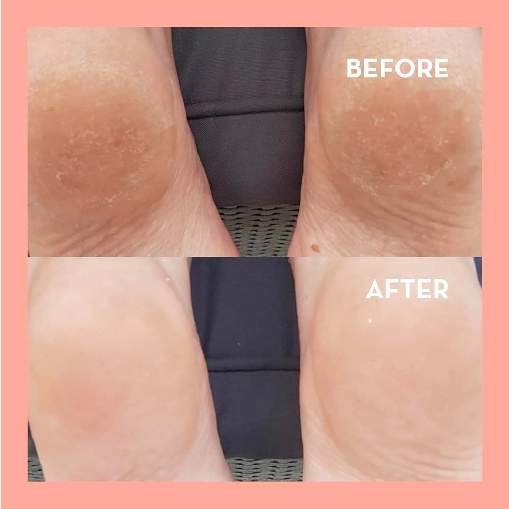 Seoulista Beauty Rosy Toes Instant Pedicure