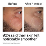 The Inkey List Starter Retionol Serum 30ml