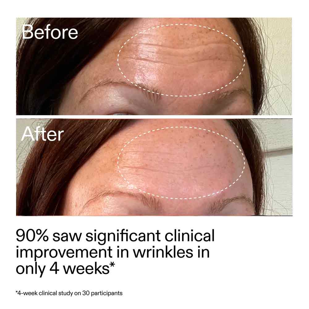 The Inkey List Starter Retionol Serum 30ml