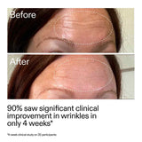 The Inkey List Starter Retionol Serum 30ml