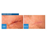 Uriage Bariederm Cica-Cream With Copper-Zinc 40ml