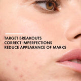 Vichy Normaderm Probio-BHA Serum Anti-Imperfections Serum 30ml