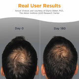 Viviscal Man Hair Growth Programme 180 Tabs