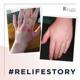 Relife Relizema Cream 40ml