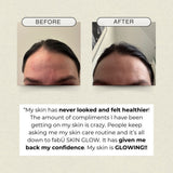 FabU Skin Glow 60 Capsules