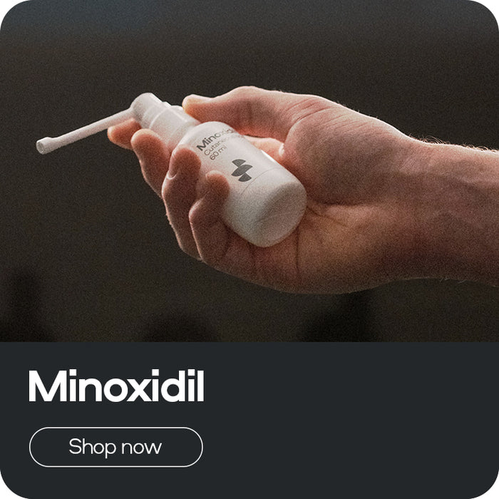 sons minoxidil for hair loss ireland